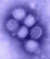 A(H1N1)v influenzavrus